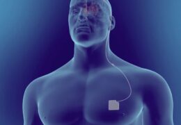 Pacemaker for Parkinson's Patients