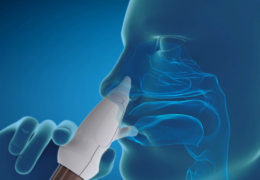 Precise Nasal Medication Delivery System