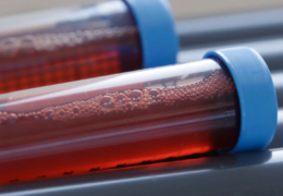Detecting Cancer Before It Spreads